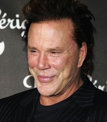 mickey-rourke-plastic-surgery